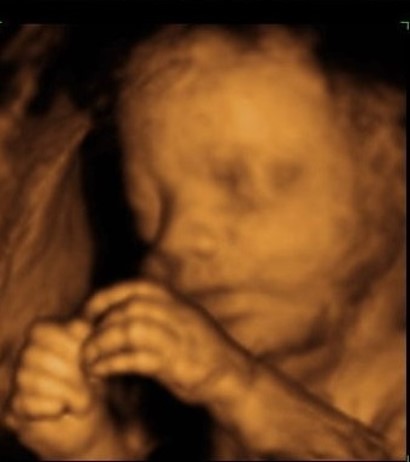 3d ultrasound scan jammu