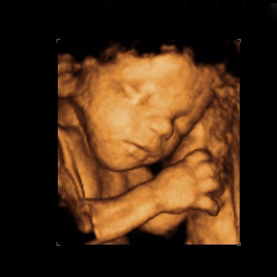 3d ultrasound scan in jammu