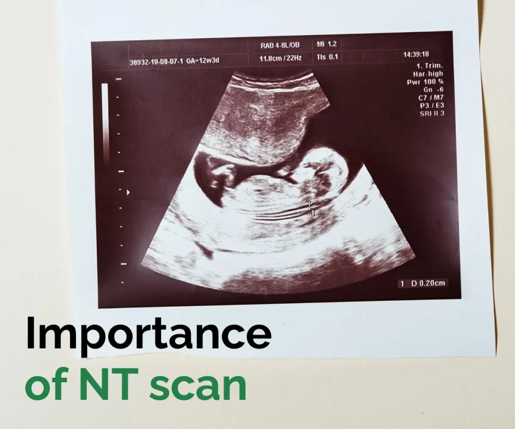nt scan price in jammu